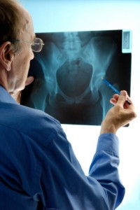 DePuy hip replacement failure