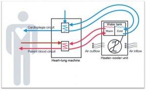 how a heater cooler works