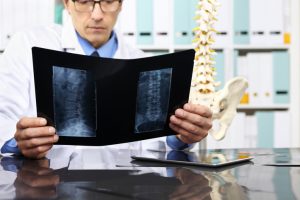doctor examines spinal x ray