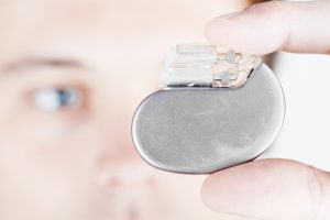 male doctor examines a pacemaker in close-up