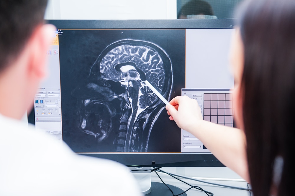 Oklahoma City Traumatic Brain Injury Lawyer 2 Doctors reviewing MRI brain scan for traumatic brain injury diagnosis