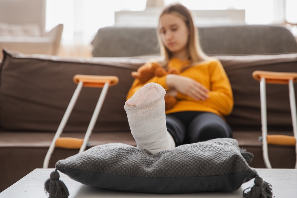 Tulsa Child Injury Lawyer 3 Child recovering at home with a leg cast after a serious injury